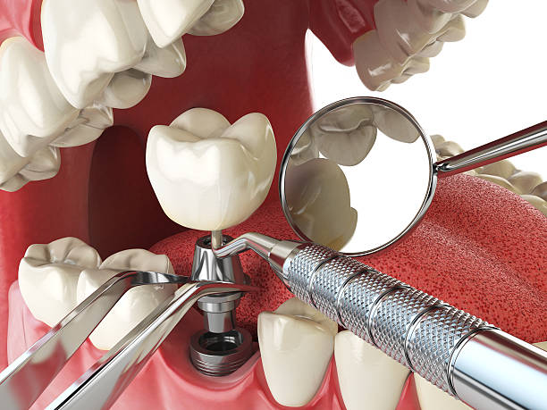 Best Mobile Emergency Dentist in Dobson, NC